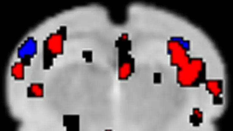 Whole brain mapping of transcranial electrical stimulation-induced effects by BOLD-fMRI in rats